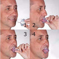 Apnea Tongue Stabilizing Device 2