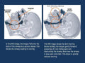 Apnea Tongue Stabilizing Device 3